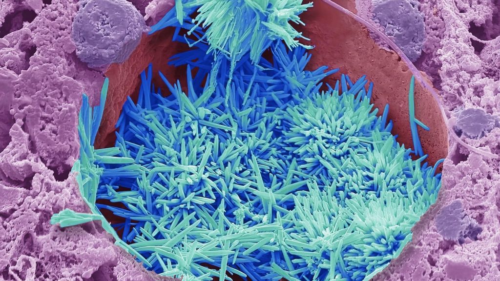 The Wellcome Photography Prize: A Lens on London's Evolving Human Story