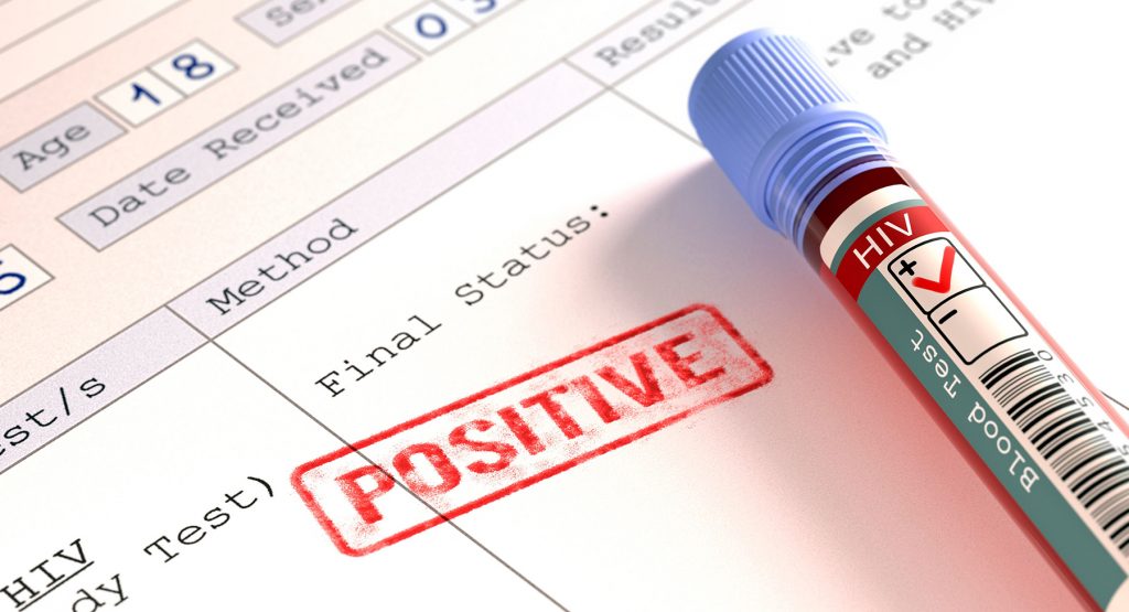 Countries with Entry Restrictions for People Living with HIV (2025)